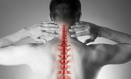 Cómo se manifiesta la osteocondrosis de la columna cervical