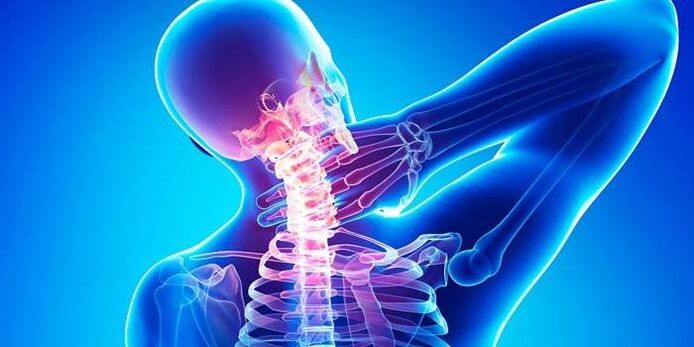 osteocondrosis cervical