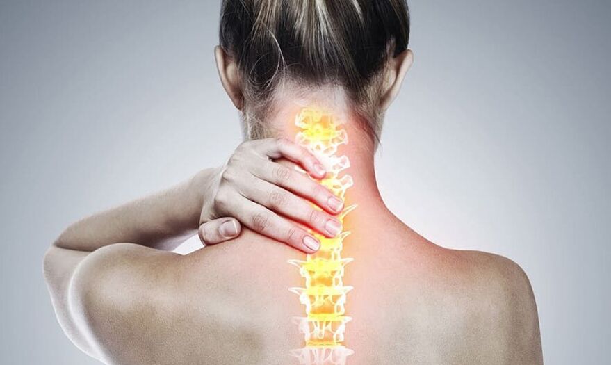 Osteocondrosis de la columna cervical.